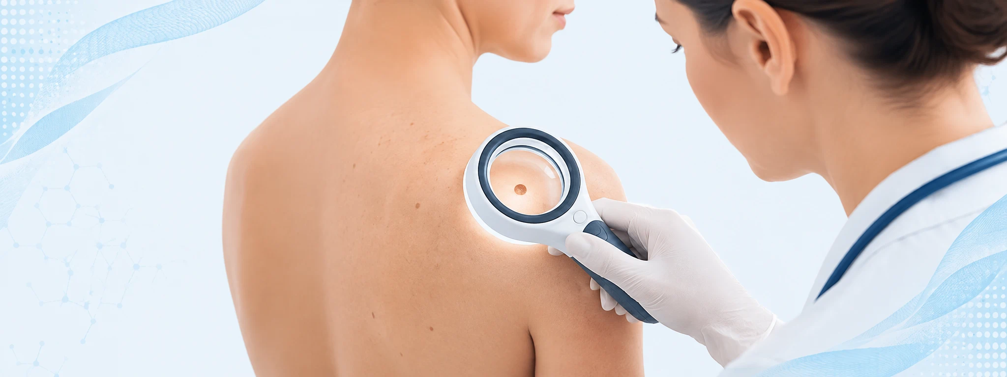 Especialista examinando la piel con un dermatoscopio